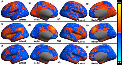 Altered Cerebro-Cerebellar Limbic Network in AD Spectrum: A Resting-State fMRI Study